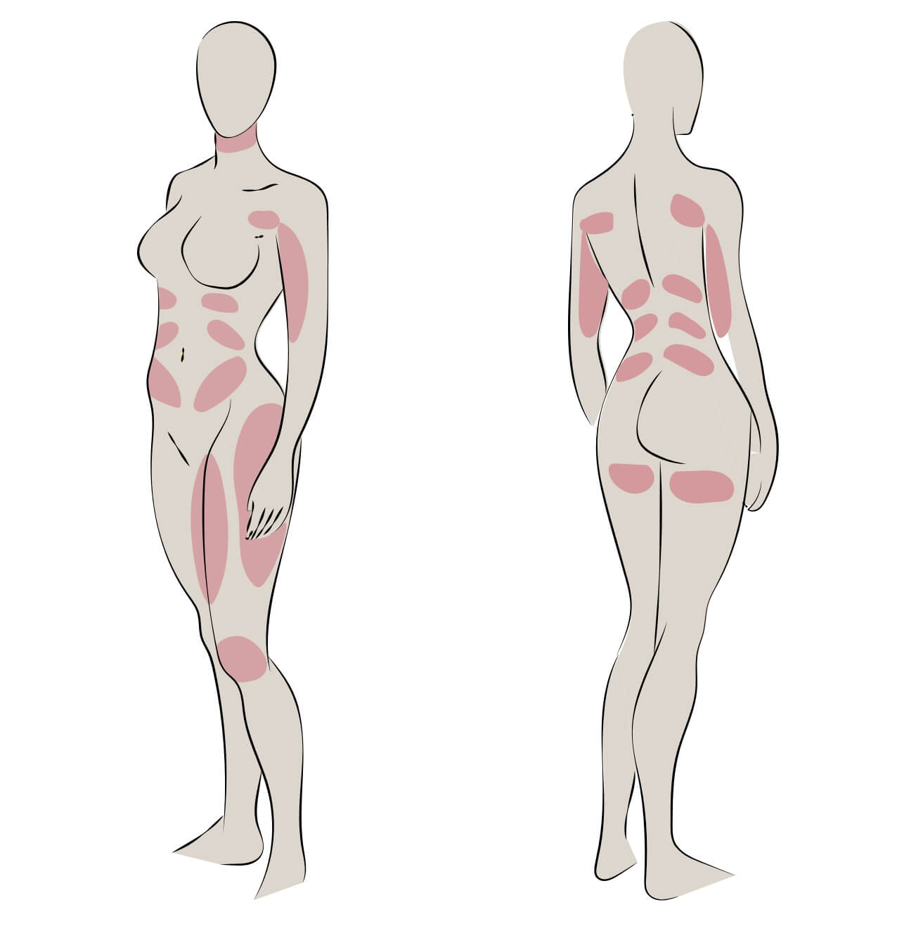 behandlungsregionen-mit-coolsculpting