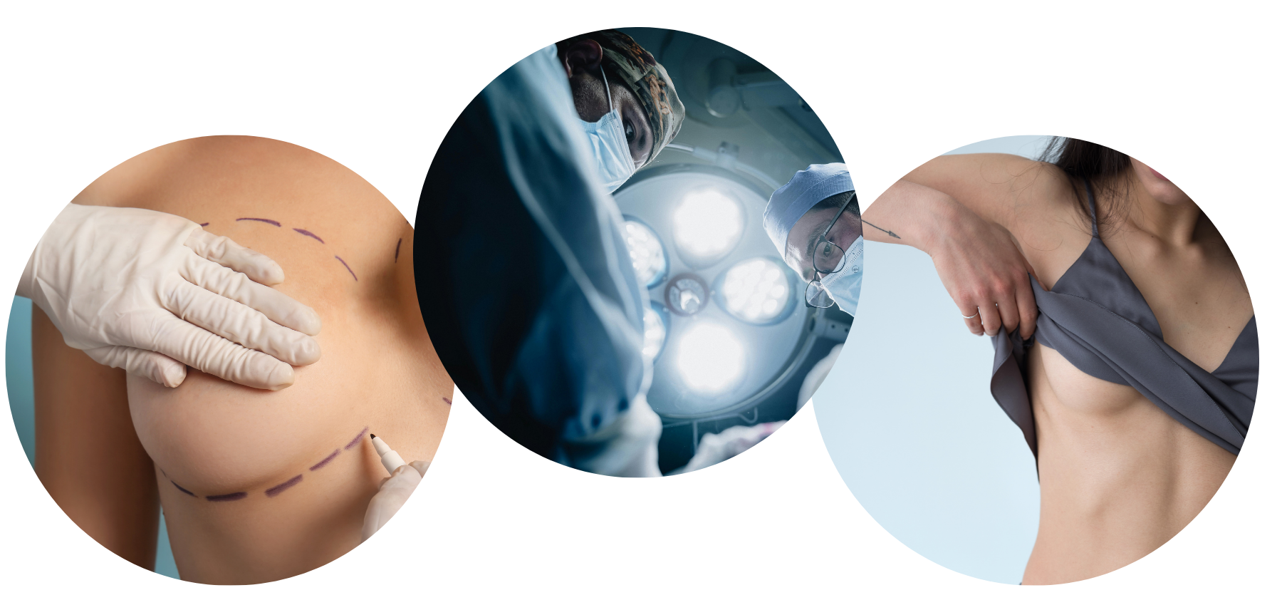 Brustverkleinerung Procedure